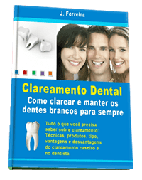 Ebook Clareamento Dental